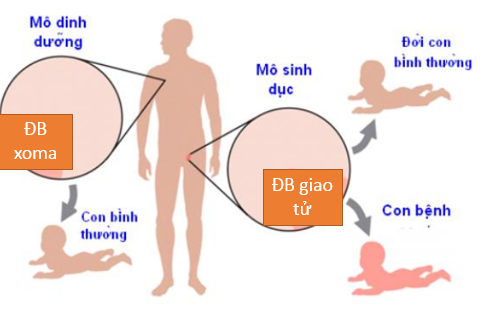 Các nguyên nhân gây ra đột biến gen 